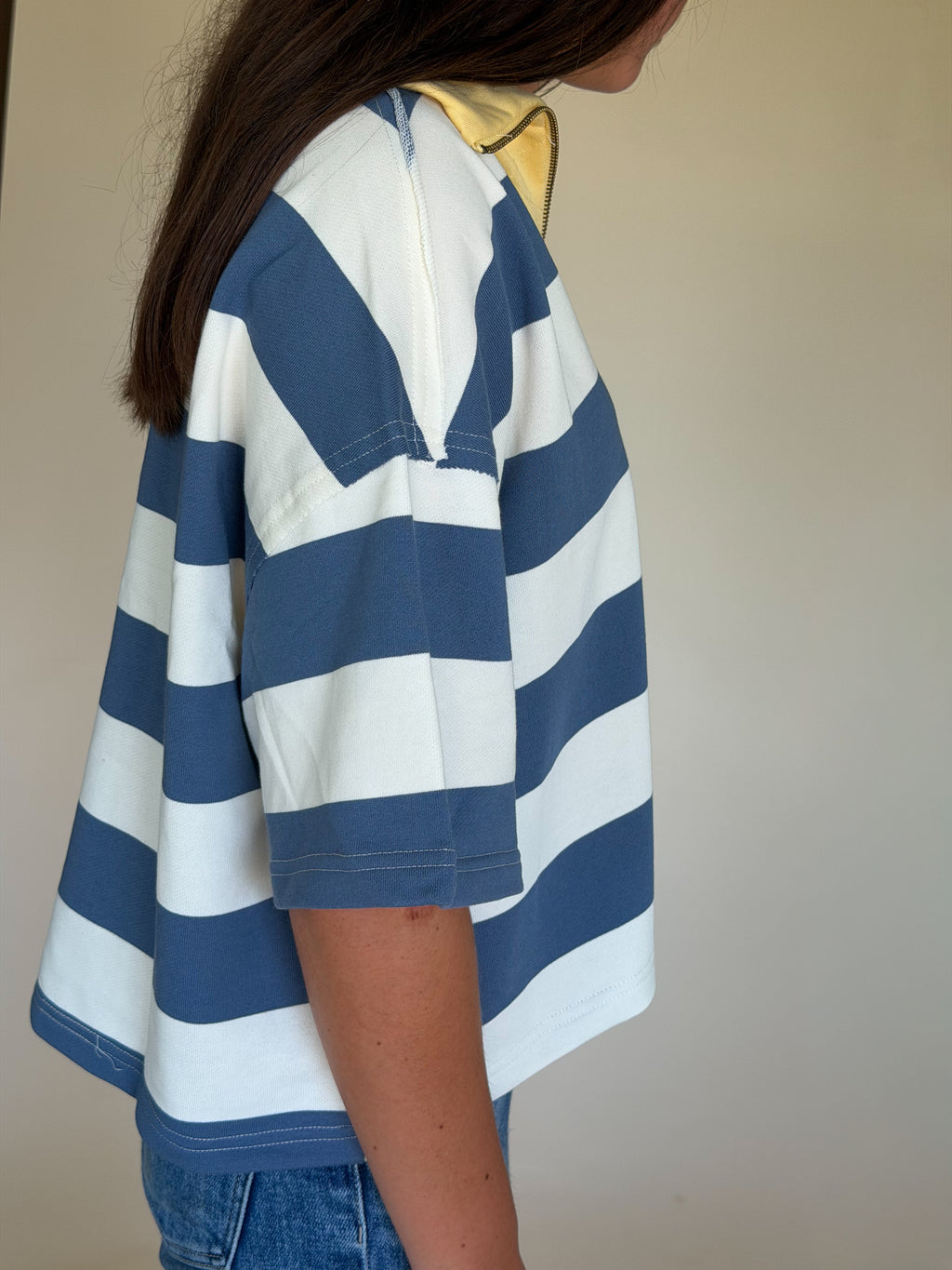 Oversized Striped Zip-Up Polo