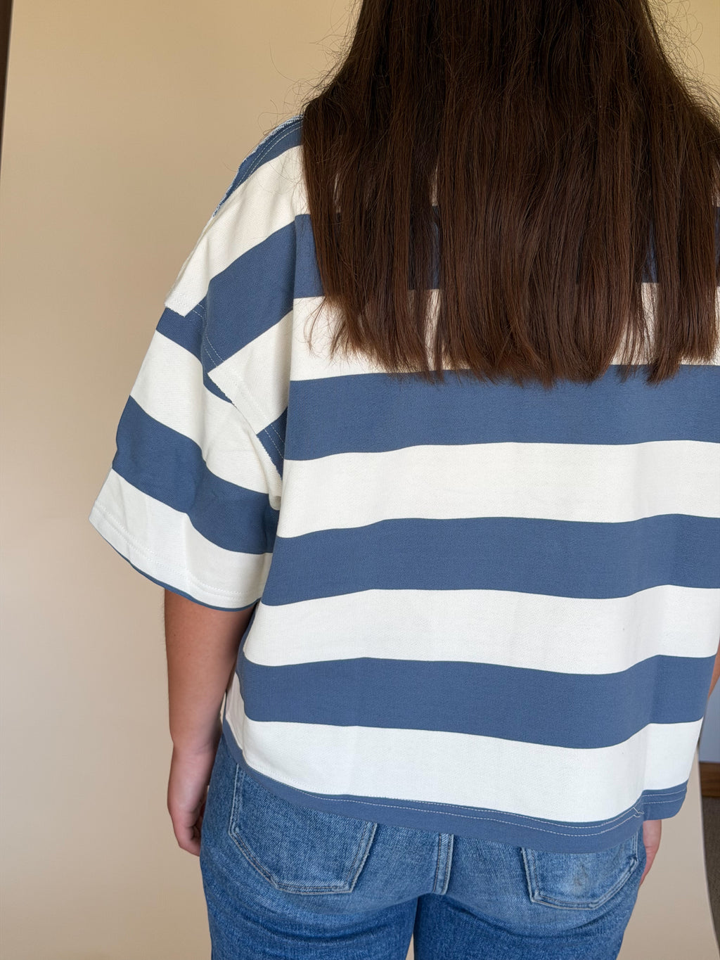 Oversized Striped Zip-Up Polo